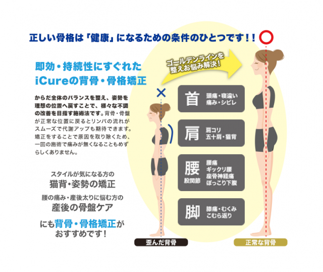 背骨・骨格矯正のイラスト